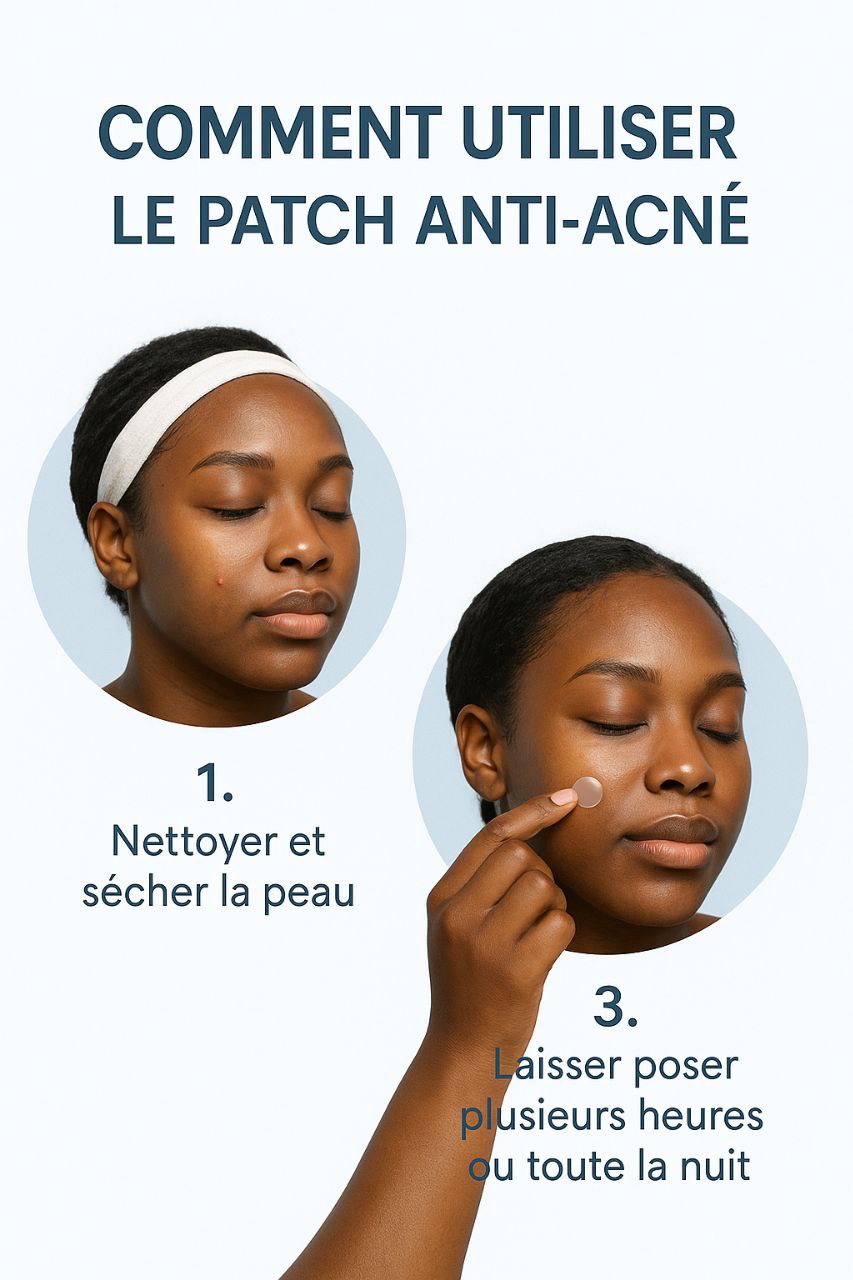 Patch anti-Acné